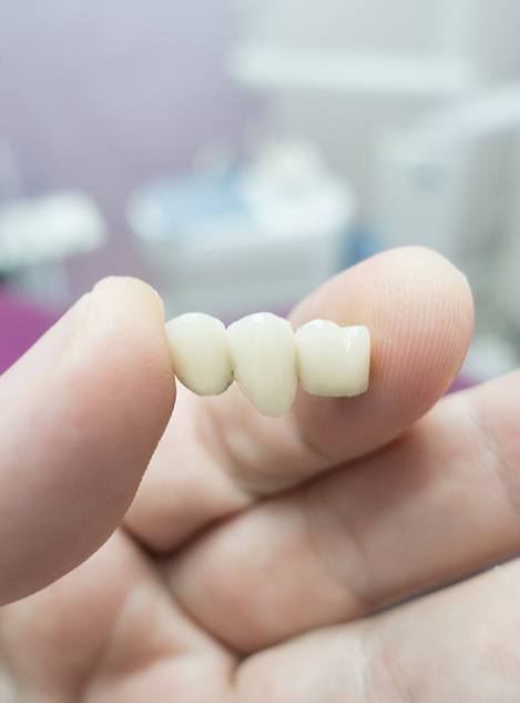 Hand holding dental bridge between thumb and forefinger 