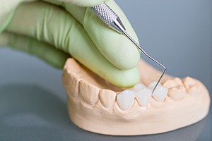 Gloved hand poking dental bridge on cast of teeth with dental instrument