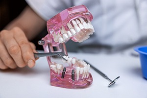 Hand using instrument to place dental bridge over implant posts in model jaw