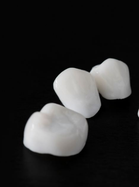 Three dental crowns against a black background