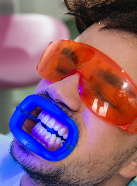 Man getting his teeth professionally whitened by Atlanta cosmetic dentist