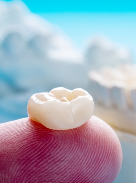 Person holding a dental crown in Buckhead Atlanta on their finger