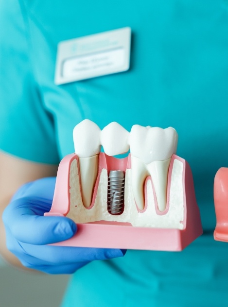 Dentist holding a model of a dental implant in Atlanta