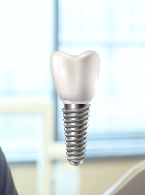 Animated dental implant with crown