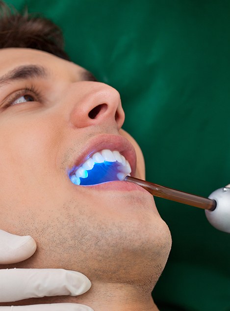 Dentist in Buckhead placing a tooth-colored filling on a patient 