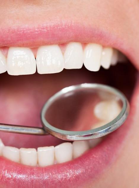 Close up of a dental mirror and a patient’s smile