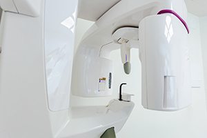 Cone beam CT scanner in dental office