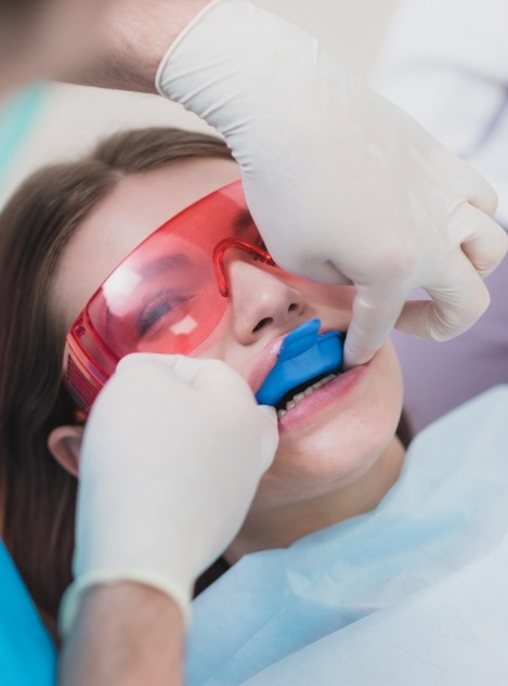 Young woman receiving fluoride treatment from dentist