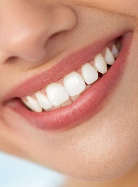 Close up of a person grinning with straight white teeth