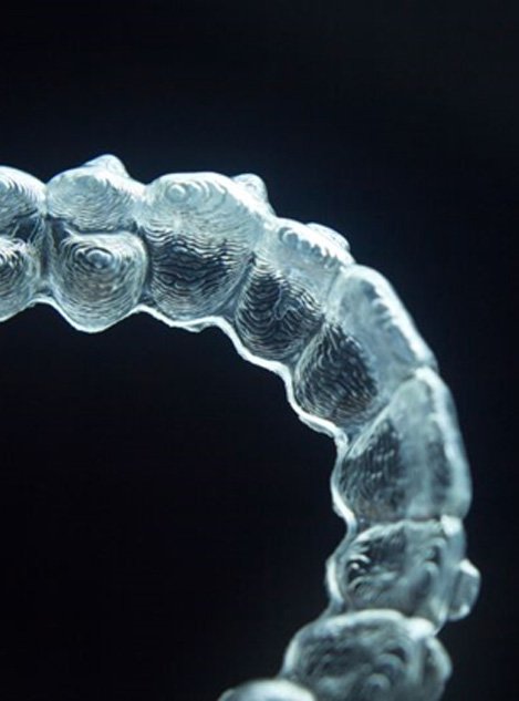 Close-up of clear aligner against dark background