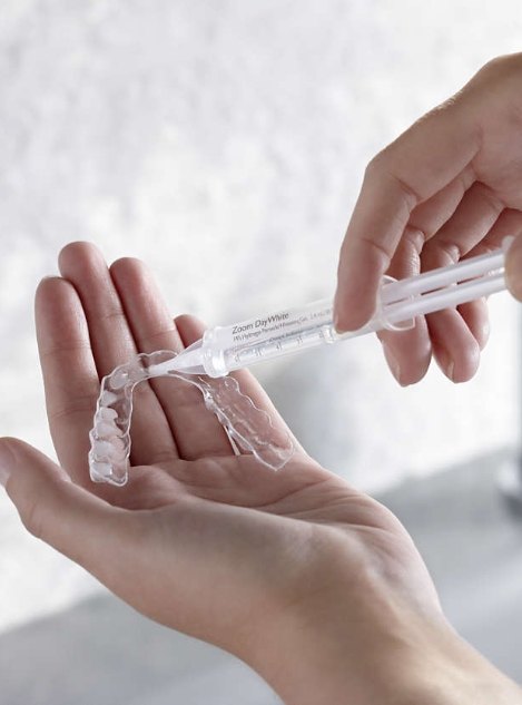 Person pouring teeth whitening gel into mouth tray