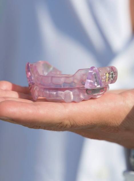 Hand holding a purple oral appliance