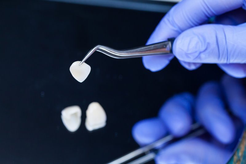 Veneer being held by tweezers