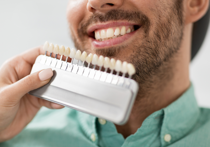 Close up of man's smiling with dentist showing him different whitening options